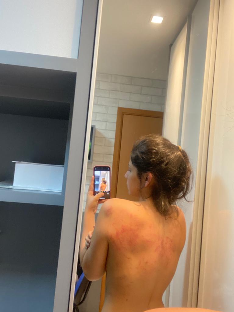 FOTOS: Novas imagens revelam agressão do médico João Paulo contra ex-esposa  em JP - Blog do BG | PB